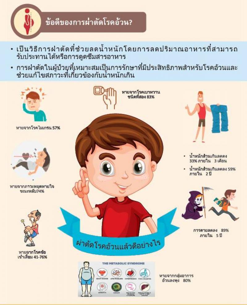 การรักษาโรคอ้วนด้วยวิธีการผ่าตัด