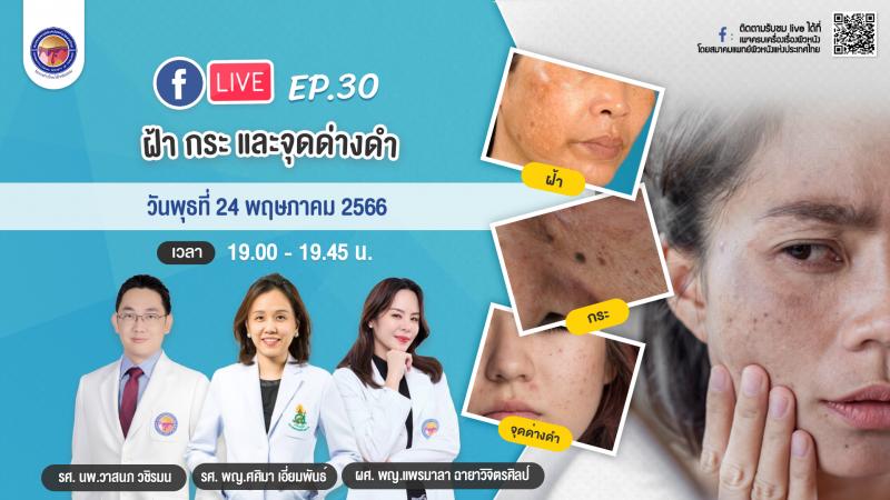 สมาคมแพทย์ผิวหนังฯ เชิญรับชมเพจเฟซบุ๊ก “ครบเครื่องเรื่องผิวหนัง” EP.30 ตอน “ฝ้า กระและจุดด่างดำ”