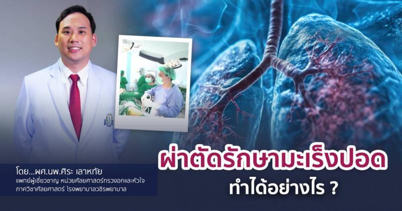 ผ่าตัดรักษามะเร็งปอด ทำได้อย่างไร