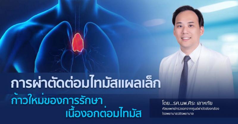 การผ่าตัดต่อมไทมัสแผลเล็ก : ก้าวใหม่ของการรักษาเนื้องอกต่อมไทมัส